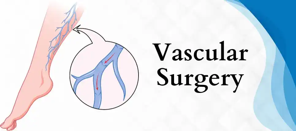 Best Vascular Surgery hospital in Hyderabad
